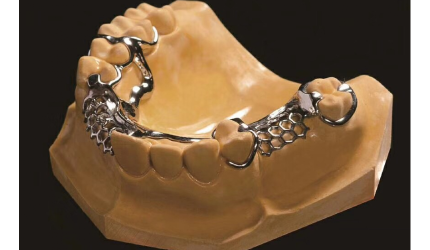 3D激光打印純鈦支架